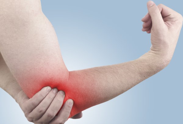 MSD priručnik simptoma bolesti: Zglobna bol, poliartikularna